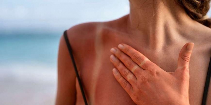 Как позаботиться о коже летом - «Здоровье»